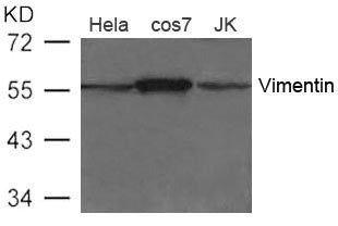 Western blot analysis of extract from Hela, cos7 and JK cells using Vimentin Antibody