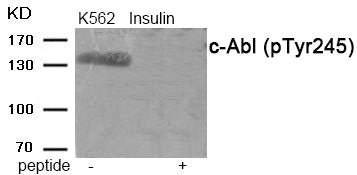 Western blot analysis of extracts from c-Abl Insulin treated K562 tissue using antibody.The lane on the right is treated with the antigen-specific peptide.