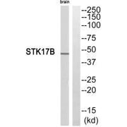 Western blot analysis of extracts from mouse brain cells, using STK17B antibody.