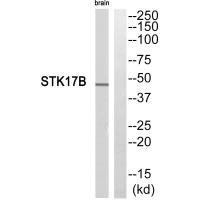 Western blot analysis of extracts from mouse brain cells, using STK17B antibody.