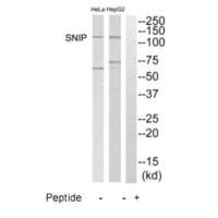 Western blot analysis of extracts from HepG2 and HeLa cells, using SNIP antibody.