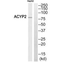 Western blot analysis of extracts from HepG2 cells, using ABCB7 antibody.
