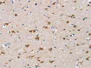 The image on the left is immunohistochemistry of paraffin-embedded Human brain tissue using CSB-PA575237(CSPG4 Antibody) at dilution 1/25, on the right is treated with synthetic peptide. (Original magnification: ×200)