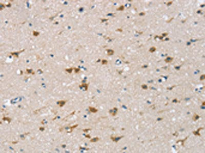 The image on the left is immunohistochemistry of paraffin-embedded Human brain tissue using CSB-PA575237(CSPG4 Antibody) at dilution 1/25, on the right is treated with synthetic peptide. (Original magnification: ×200)