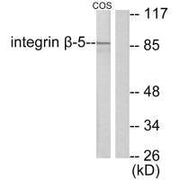 Western blot analysis of extracts from COS7 cells, using Integrin β5 antibody.