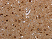 The image on the left is immunohistochemistry of paraffin-embedded Human brain tissue using CSB-PA575736(MTBP Antibody) at dilution 1/20, on the right is treated with synthetic peptide. (Original magnification: ×200)