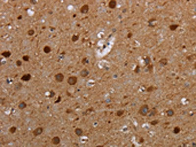 The image on the left is immunohistochemistry of paraffin-embedded Human brain tissue using CSB-PA575736(MTBP Antibody) at dilution 1/20, on the right is treated with synthetic peptide. (Original magnification: ×200)