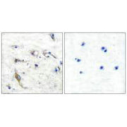 Immunohistochemical analysis of paraffin-embedded human brain tissue using JM4 antibody.