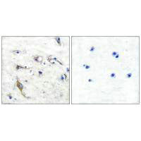 Immunohistochemical analysis of paraffin-embedded human brain tissue using JM4 antibody.