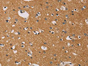 The image on the left is immunohistochemistry of paraffin-embedded Human brain tissue using CSB-PA576542(CD22 Antibody) at dilution 1/50, on the right is treated with fusion protein. (Original magnification: ×200)
