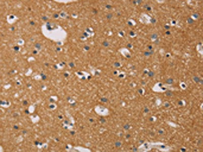The image on the left is immunohistochemistry of paraffin-embedded Human brain tissue using CSB-PA576542(CD22 Antibody) at dilution 1/50, on the right is treated with fusion protein. (Original magnification: ×200)