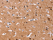 The image on the left is immunohistochemistry of paraffin-embedded Human brain tissue using CSB-PA576885(CHRM1 Antibody) at dilution 1/20, on the right is treated with fusion protein. (Original magnification: ×200)
