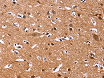 The image on the left is immunohistochemistry of paraffin-embedded Human brain tissue using CSB-PA576885(CHRM1 Antibody) at dilution 1/20, on the right is treated with fusion protein. (Original magnification: ×200)