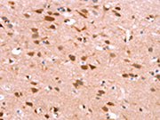 The image on the left is immunohistochemistry of paraffin-embedded Human brain tissue using CSB-PA576969(GH1 Antibody) at dilution 1/40, on the right is treated with synthetic peptide. (Original magnification: ×200)