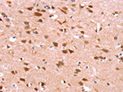 The image on the left is immunohistochemistry of paraffin-embedded Human brain tissue using CSB-PA576969(GH1 Antibody) at dilution 1/40, on the right is treated with synthetic peptide. (Original magnification: ×200)