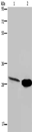Gel: 8%SDS-PAGE, Lysate: 40 ug, Lane 1-2: Human hepatocellular carcinoma tissue, mouse skeletal muscle tissue, Primary antibody: CSB-PA577055(CA3 Antibody) at dilution 1/200, Secondary antibody: Goat anti rabbit IgG at 1/8000 dilution, Exposure ti...
