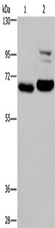 Gel: 6%SDS-PAGE, Lysate: 40 ug, Lane 1-2: K562 cells, NIH/3T3 cells, Primary antibody: CSB-PA577148(OS9 Antibody) at dilution 1/200, Secondary antibody: Goat anti rabbit IgG at 1/8000 dilution, Exposure time: 3 minutes