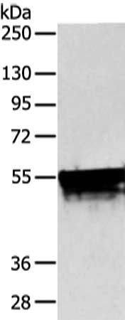 Gel: 8%SDS-PAGE, Lysate: 40 ug, Lane: Hela cell, Primary antibody: CSB-PA577356(KRT4 Antibody) at dilution 1/800 dilution, Secondary antibody: Goat anti rabbit IgG at 1/8000 dilution, Exposure time: 15 seconds