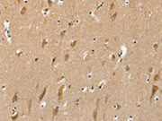 The image on the left is immunohistochemistry of paraffin-embedded Human brain tissue using CSB-PA577390(SLC6A7 Antibody) at dilution 1/30, on the right is treated with synthetic peptide. (Original magnification: ×200)