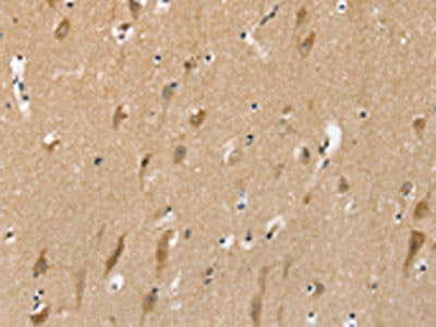 The image on the left is immunohistochemistry of paraffin-embedded Human brain tissue using CSB-PA577390(SLC6A7 Antibody) at dilution 1/30, on the right is treated with synthetic peptide. (Original magnification: ×200)