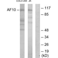 Western blot analysis of extracts from COLO205 cells and Jurkat cells, using AF10 antibody.
