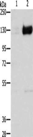 Gel: 8%SDS-PAGE, Lysate: 40 ug, Lane 1-2: 293T cells untreated with cobalt chloride, 293T cells treated with cobalt chloride (0.1 mM for 4 hours), Primary antibody: CSB-PA578243(HIF1A Antibody) at dilution 1/750, Secondary antibody: Goat anti rabb...