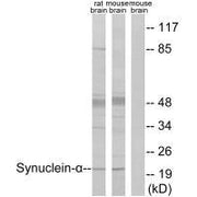 Western blot analysis of extracts from rat brain and mouse brain, using Synuclein-α (Ab-125) antibody.