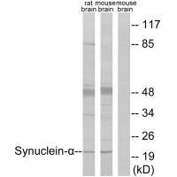 Western blot analysis of extracts from rat brain and mouse brain, using Synuclein-α (Ab-125) antibody.