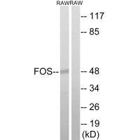Western blot analysis of extracts from RAW264.7 cells, using FOS (Ab-232) antibody.