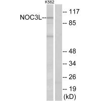 Western blot analysis of extracts from K562 cells, using NOC3L antibody.