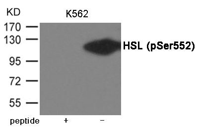 Western blot analysis of extracts from K562 cells using HSL (Phospho-Ser552) Antibody.The lane on the left is treated with the antigen-specific peptide.