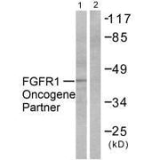 Western blot analysis of extracts from HepG2 cells, using FGFR1 Oncogene Partner antibody.