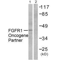 Western blot analysis of extracts from HepG2 cells, using FGFR1 Oncogene Partner antibody.