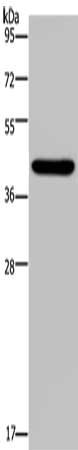 Western blot analysis of lysates from Jurkat cells, primary antibody was diluted at 1:1000