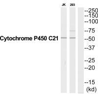 Western blot analysis of extracts from Jurkat/293 cells, using CYP21A2 antibody.