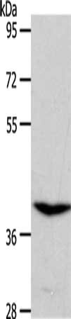 Gel: 10%SDS-PAGE, Lysate: 50 ug, Lane: Rat kidney tissue, Primary antibody: CSB-PA580045(S1PR4 Antibody) at dilution 1/250, Secondary antibody: Goat anti rabbit IgG at 1/8000 dilution, Exposure time: 20 seconds