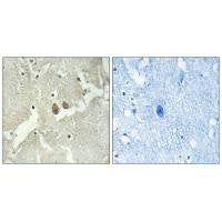 Immunohistochemistry analysis of paraffin-embedded human brain tissue using NSG2 antibody.