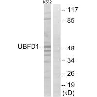 Western blot analysis of extracts from K562 cells, using UBFD1 antibody.