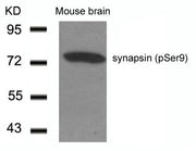 Western blot analysis of extracts from Mouse Brain tissue using synapsin(Phospho-Ser9) Antibody.