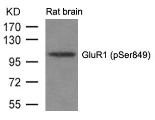 Western blot analysis of extracts from Rat brain tissue using GluR1(phospho-Ser849) Antibody.