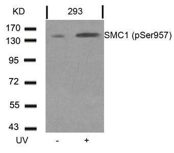 Western blot analysis of extracts from 293 cells untreated or treated with UV using SMC1(Phospho-Ser957) Antibody.