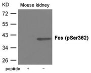 Western blot analysis of extracts from Mouse kidney tissue using Fos (Phospho-Ser362) Antibody.The lane on the left is treated with the antigen-specific peptide.
