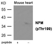 Western blot analysis of extracts from Mouse heart tissue using NPM (Phospho-Thr199) Antibody.The lane on the left is treated with the antigen-specific peptide.