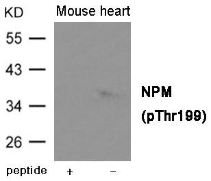 Western blot analysis of extracts from Mouse heart tissue using NPM (Phospho-Thr199) Antibody.The lane on the left is treated with the antigen-specific peptide.