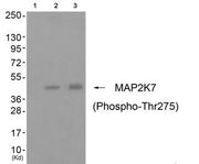Western blot analysis of extracts from cos-7 cells (Lane 2) and 3T3 cells (Lane 3), using MAP2K7 (Phospho-Thr275) Antibody. The lane on the left is treated with antigen-specific peptide.