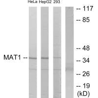 Western blot analysis of extracts from HeLa cells, HepG2 cells and 293 cells, using MAT1 antibody.