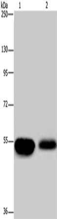 Gel: 8%SDS-PAGE, Lysate: 50 ug, Lane 1-2: Human fetal brain tissue, mouse brain tissue, Primary antibody: CSB-PA583474(APBA1 Antibody) at dilution 1/200, Secondary antibody: Goat anti rabbit IgG at 1/8000 dilution, Exposure time: 10 seconds