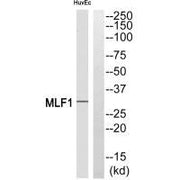 Western blot analysis of extracts from HUVEC cells, using MLF1 antibody.