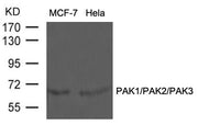 Western blot analysis of extracts from MCF-7 and Hela cells using PAK1/PAK2/PAK3(Ab-423/402/421) Antibody.