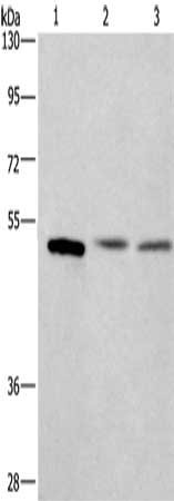 Gel: 10%SDS-PAGE, Lysate: 40 ug, Lane 1-3: Mouse intestinum tenue tissue, human colon cancer tissue, Human testis tissue, Primary antibody: CSB-PA584227(CEP55 Antibody) at dilution 1/350, Secondary antibody: Goat anti rabbit IgG at 1/8000 dilution...